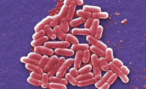 Alertan por brote de infecciones por ecoli en EU; retiran blueberries y frutos rojos mixtos congelados GreenWise