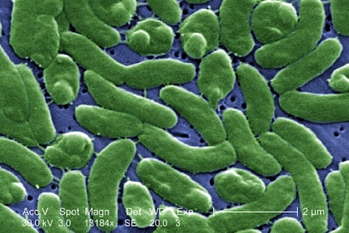 Detectan bacteria carnívora en aguas costeras de EU; autoridades de salud lanzan alerta