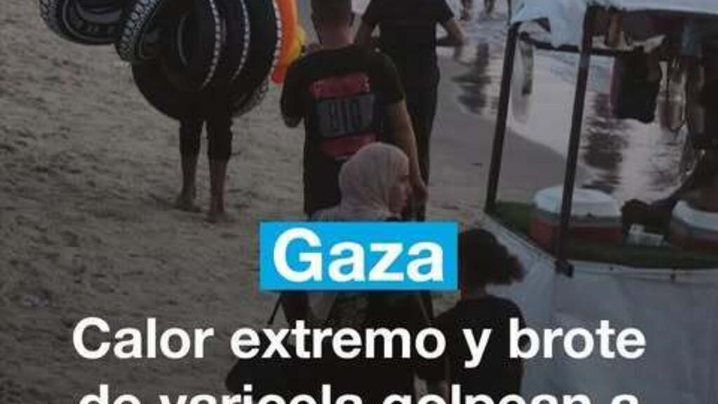 Gaza: calor extremo y un brote de varicela con más de 58.000 casos golpean a los desplazados