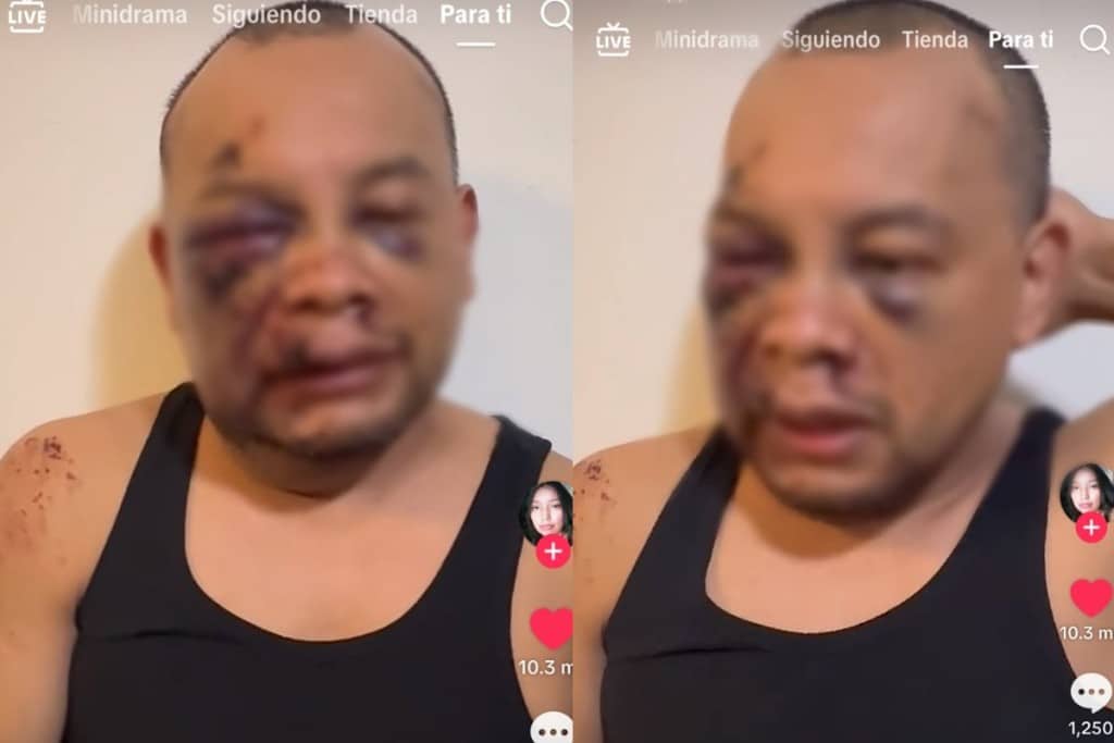 VIDEO | Migrante mexicano asegura que agentes de ICE lo golpearon y dejaron inconsciente en Virginia