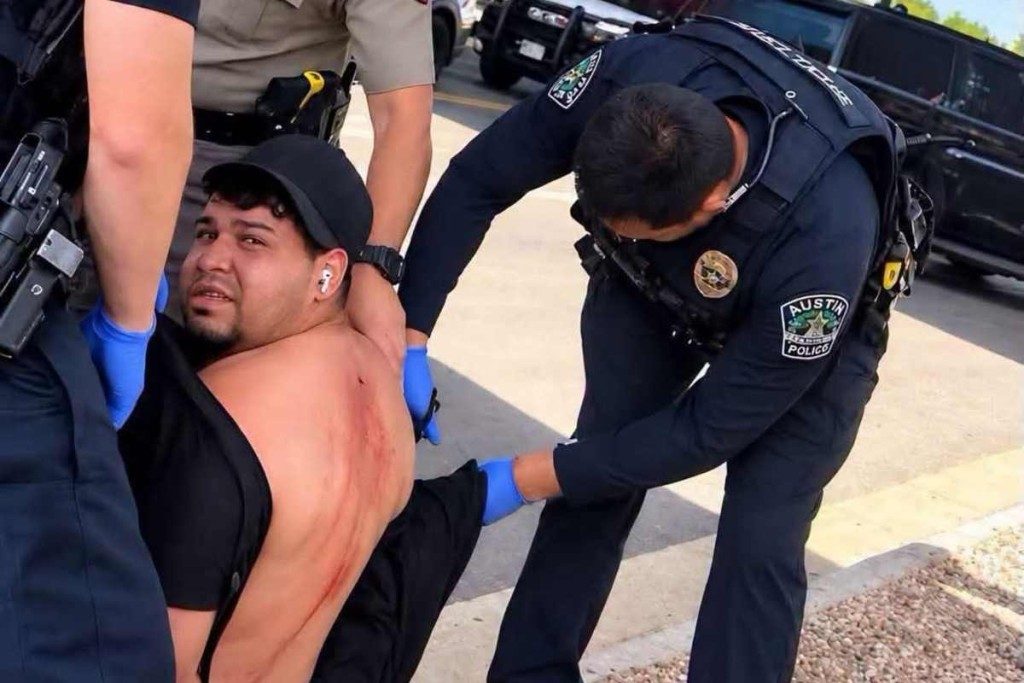 “¿Cómo me van a dejar la bala ahí?” Wilber Garcés relata cómo ICE abrió fuego en su contra