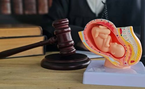 Condenan a prisión a mujer por practicar aborto sin licencia médica en Rusia; la víctima sufrió múltiples lesiones corporales