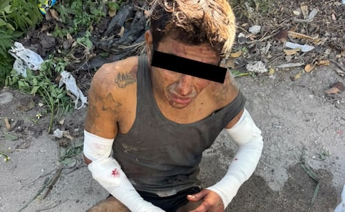 Pitbull frustra intento de robo en Yucatán; intruso termina con múltiples lesiones