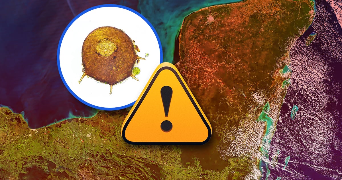 ‘Tiene letalidad mayor al 97%’: Salud de Yucatán alerta por ameba ‘comecerebros’ en lagos artificiales
